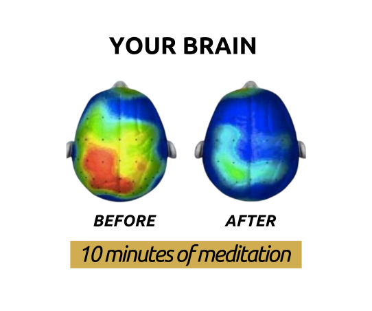Brain after meditation — image from the original Ralkhemia website